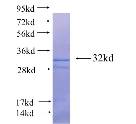 Recombinant human LIMS1(Full length) SDS-PAGE