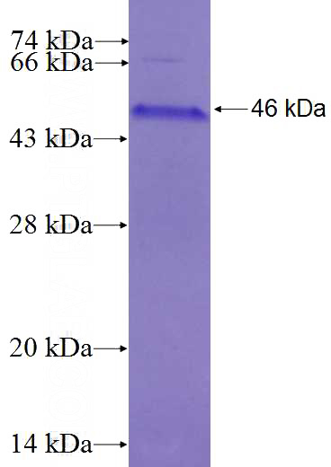 Recombinant Human UBE2J1 SDS-PAGE