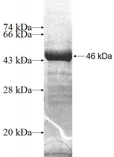 Recombinant Human REEP2 SDS-PAGE