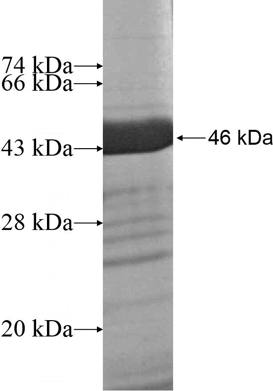 Recombinant Human NEBL SDS-PAGE