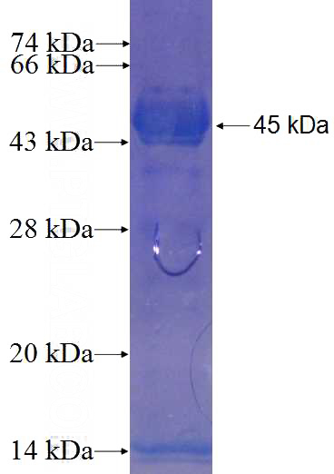 Recombinant Human KIAA1274 SDS-PAGE