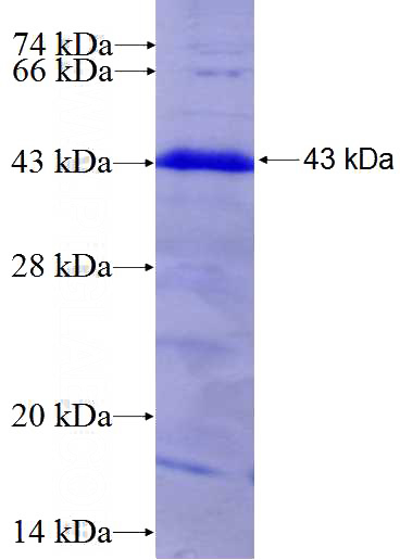 Recombinant Human CARD14 SDS-PAGE