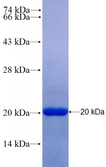 Recombinant Human GLI1 SDS-PAGE