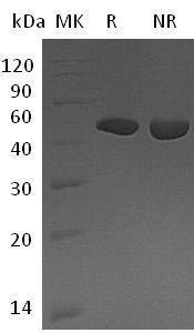 Human CPB1/CPB/PCPB (His tag) recombinant protein