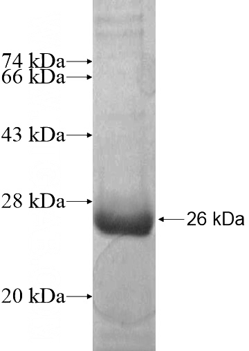Recombinant Human MAST4 SDS-PAGE