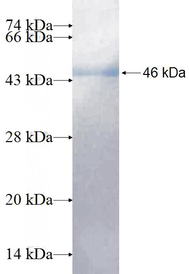 Recombinant Human MVD SDS-PAGE