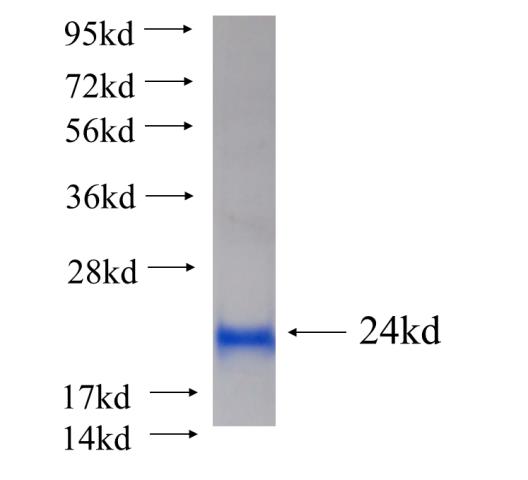 Recombinant human MKNK2(Full length) SDS-PAGE