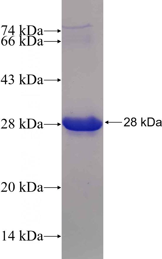 Recombinant Human CHD5 SDS-PAGE