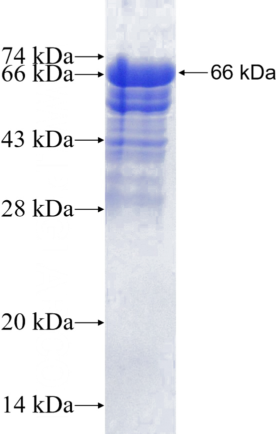 Recombinant Human C13orf3 SDS-PAGE