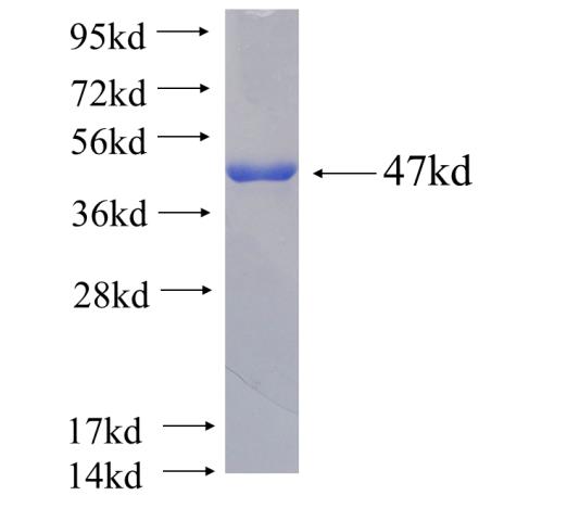 Recombinant human ARF5(Full length) SDS-PAGE