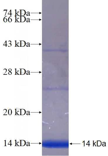 Recombinant Human MFSD8 SDS-PAGE