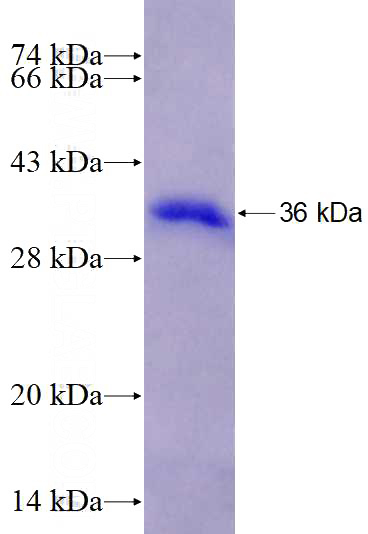 Recombinant Human KLHL38 SDS-PAGE