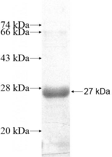 Recombinant Human DNAJC5B SDS-PAGE