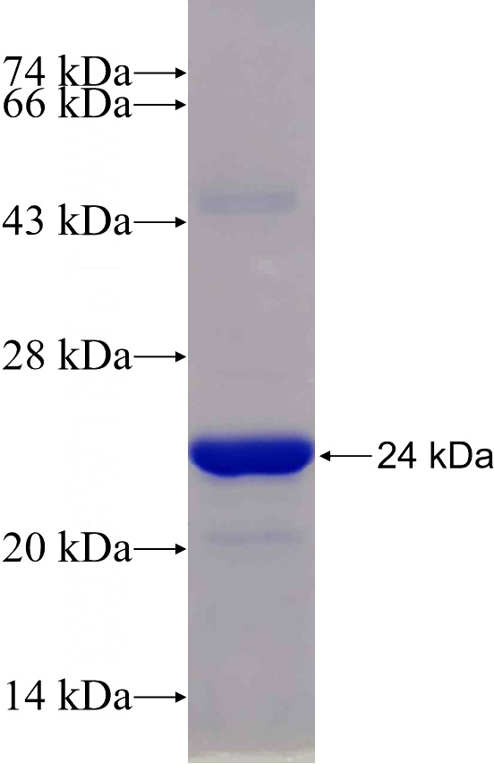 Recombinant Human GSDMB SDS-PAGE