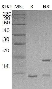 Mouse S100a8/Caga/Mrp8 (His tag) recombinant protein