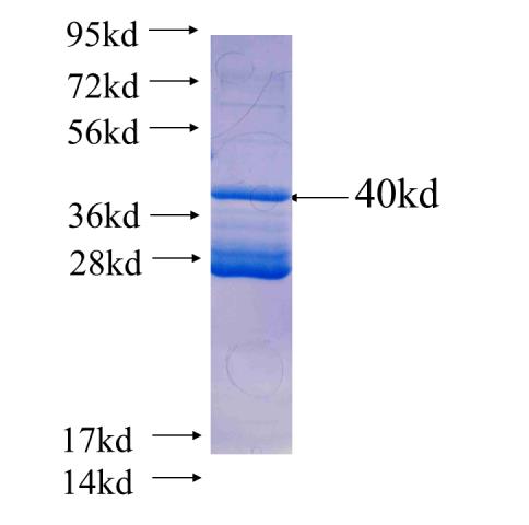 Recombinant human STAG2 SDS-PAGE