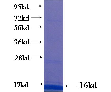 Recombinant human ZC3H12D SDS-PAGE