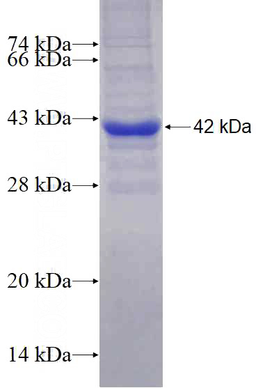 Recombinant Human DPYSL2 SDS-PAGE