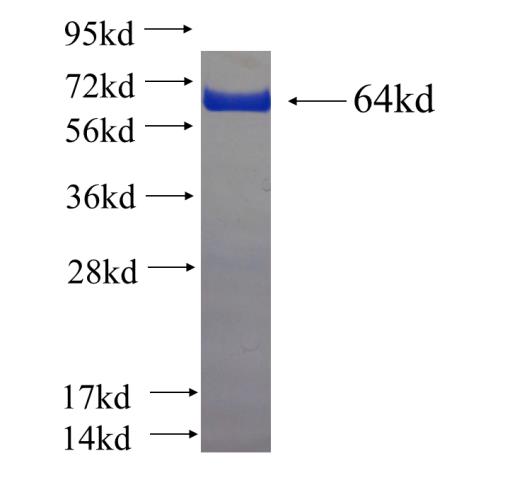 Recombinant human EVPL SDS-PAGE