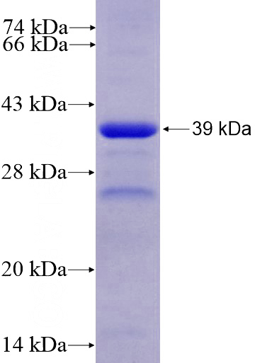 Recombinant Human FNIP1 SDS-PAGE