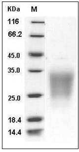 Human SIGIRR / TIR8 Protein (His Tag) SDS-PAGE