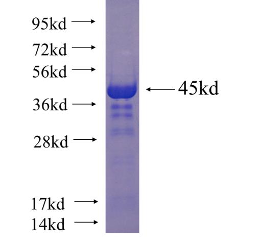 Recombinant human C13orf3 SDS-PAGE