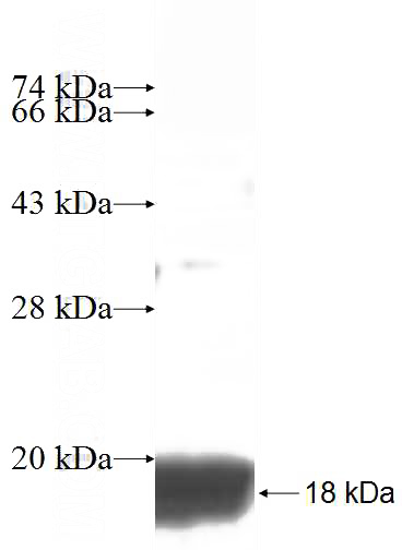 Recombinant Human DDA1 SDS-PAGE