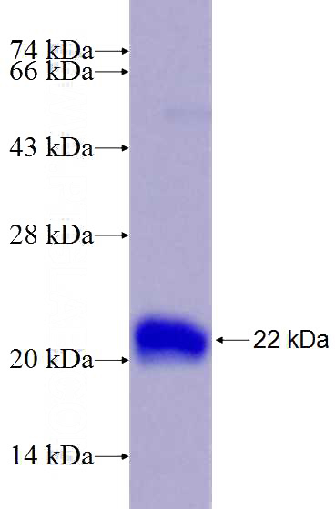 Recombinant Human GRP SDS-PAGE