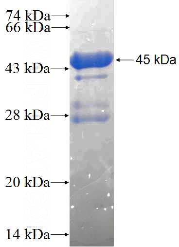 Recombinant Human OCA2 SDS-PAGE
