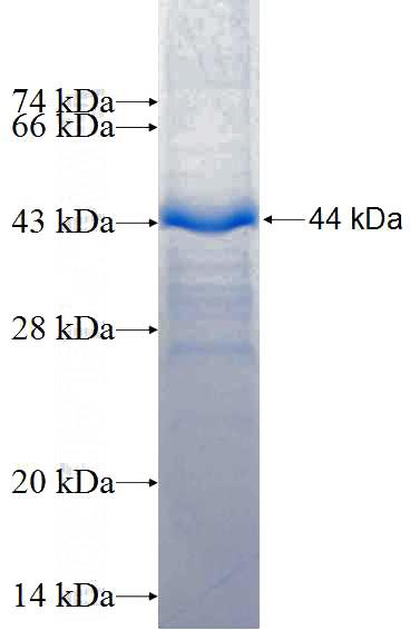 Recombinant Human DCT SDS-PAGE