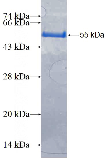 Recombinant Human SAFB SDS-PAGE