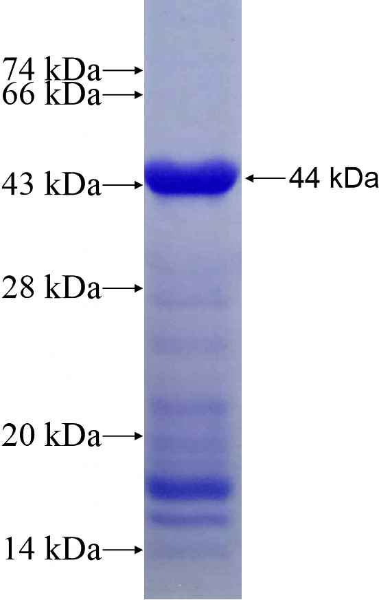 Recombinant Human PLCL2 SDS-PAGE