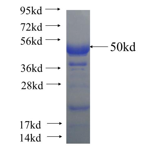 Recombinant human NCOA6 SDS-PAGE