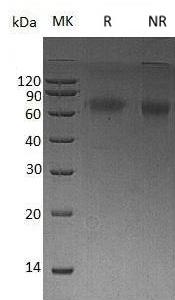 Human DKK3/REIC/UNQ258/PRO295 (His tag) recombinant protein