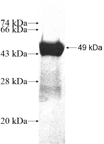 Recombinant Human MYL6B SDS-PAGE
