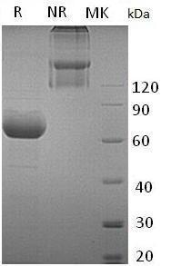 Human IL2RB/IL15RB (Fc tag) recombinant protein