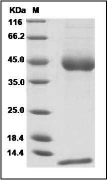 Human CD1D & B2M Heterodimer Protein SDS-PAGE