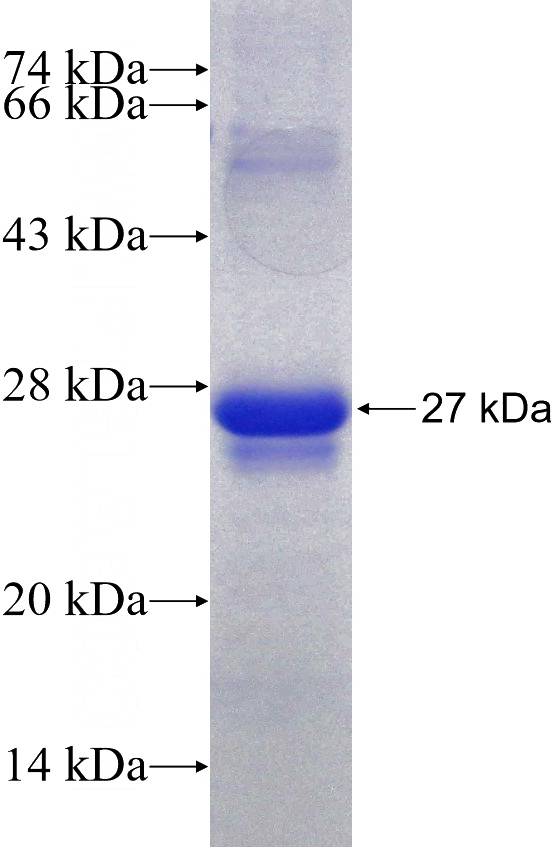 Recombinant Human NKX2-8 SDS-PAGE
