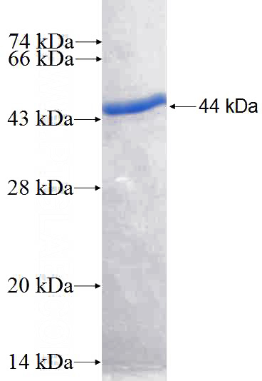 Recombinant Human CDV3 SDS-PAGE