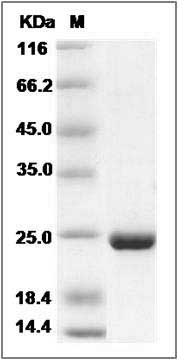 Human PMVK / phosphomevalonate kinase Protein (His Tag) SDS-PAGE