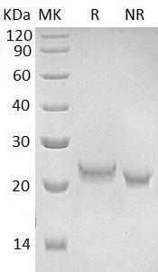 Human IFNW1 (His tag) recombinant protein