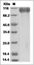 Human MEP1B / Meprin beta Protein (His Tag)