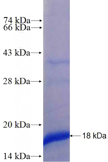 Recombinant Human RABL5 SDS-PAGE