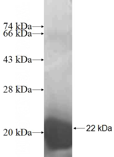 Recombinant Human Calbindin SDS-PAGE