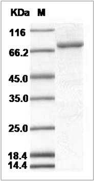 Human Bruton Tyrosine Kinase / BTK Kinase Protein (His Tag) SDS-PAGE
