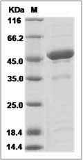 Human 4-1BBL / CD137L Protein (Fc Tag)