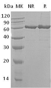Mouse Nt5e/Nt5/Nte (His tag) recombinant protein