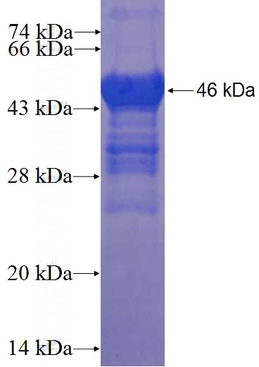 Recombinant Human SLC6A5 SDS-PAGE