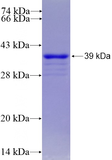 Recombinant Human SLC11A2 SDS-PAGE