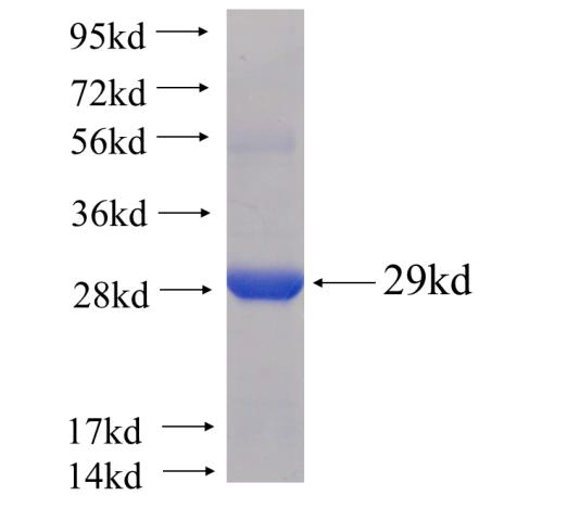 Recombinant human ARFRP1(Full length) SDS-PAGE